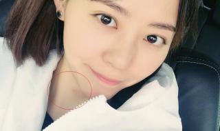 蚊子居然还有头发 蚊子居然还有头发